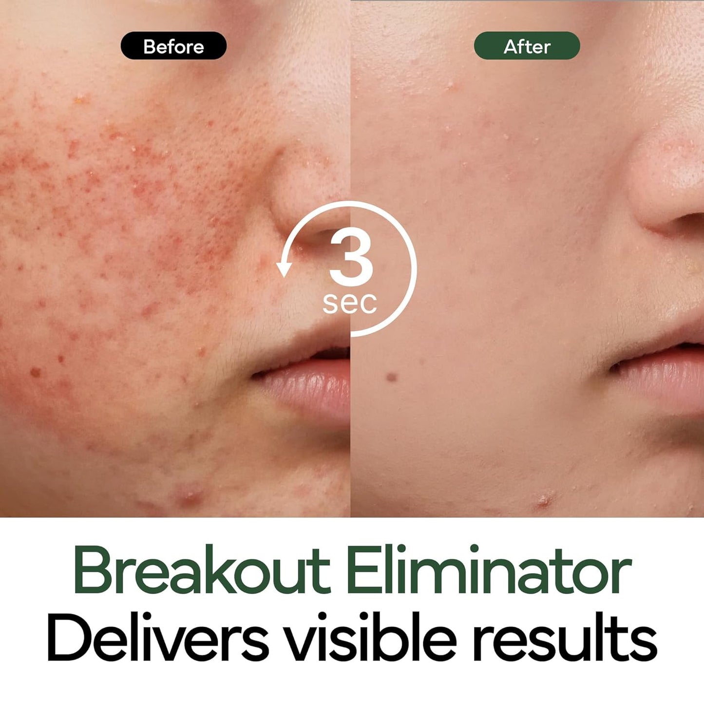 ⏳Last 3 hours: 60% off🕒Intensive Cica Repair Cream – Calm & Repair Damaged Skin, Perfect for Sensitive Skin